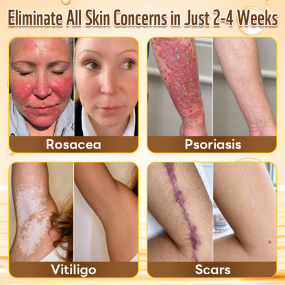 HISKIN® Multi-Concern Skin Repair Cream ✨✨ (One powerful cream to repair inflammation, dryness, aging, pigmentation, and visible skin damage.)