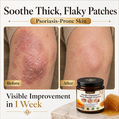 ✨✨HISKIN® Multi-Concern Skin Repair Cream (One powerful cream to repair inflammation, dryness, aging, pigmentation, and visible skin damage.)