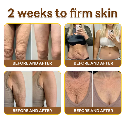 HISKIN® Multi-Concern Skin Repair Cream ✨✨ (One powerful cream to repair inflammation, dryness, aging, pigmentation, and visible skin damage.)
