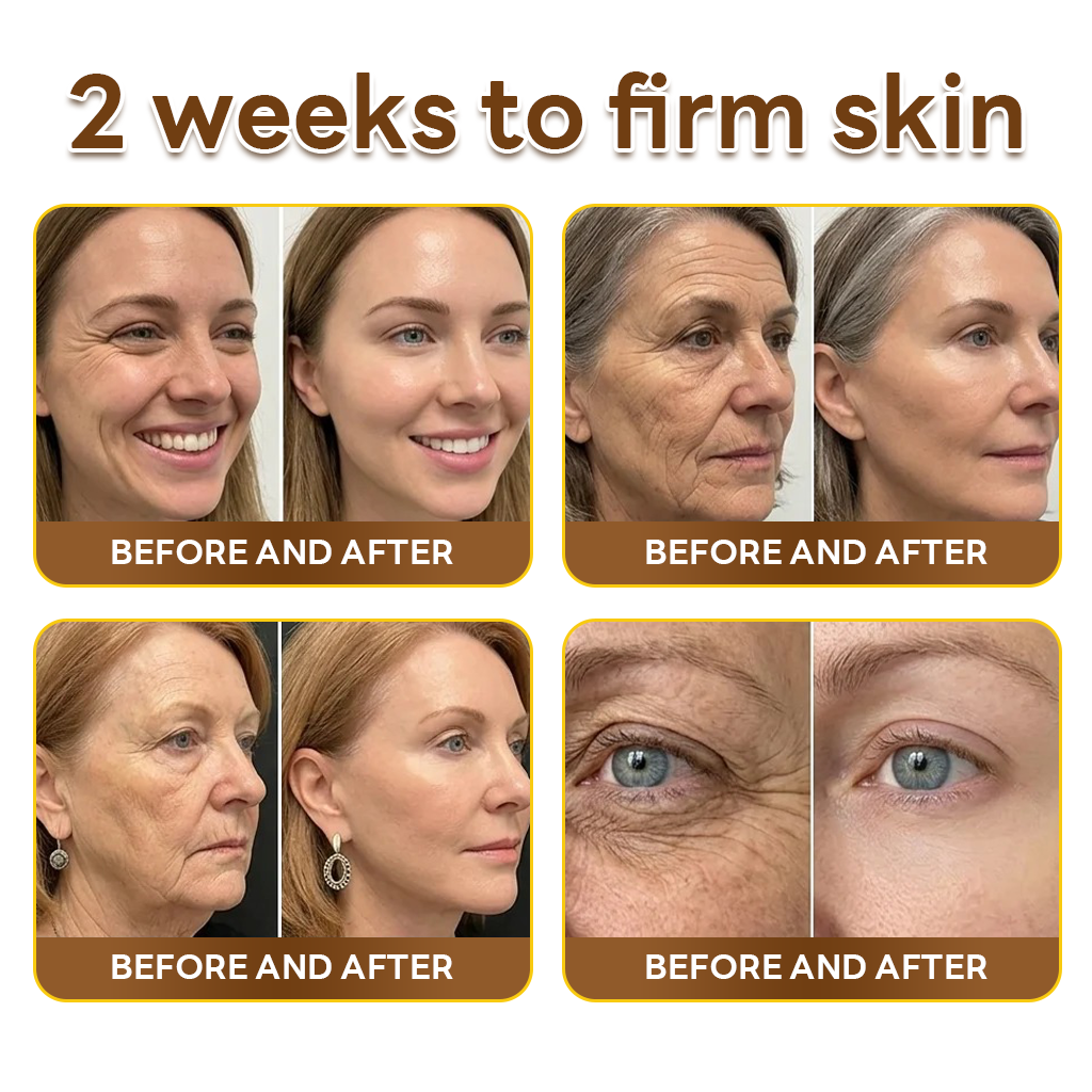 HISKIN® Multi-Concern Skin Repair Cream ✨✨ (One powerful cream to repair inflammation, dryness, aging, pigmentation, and visible skin damage.)