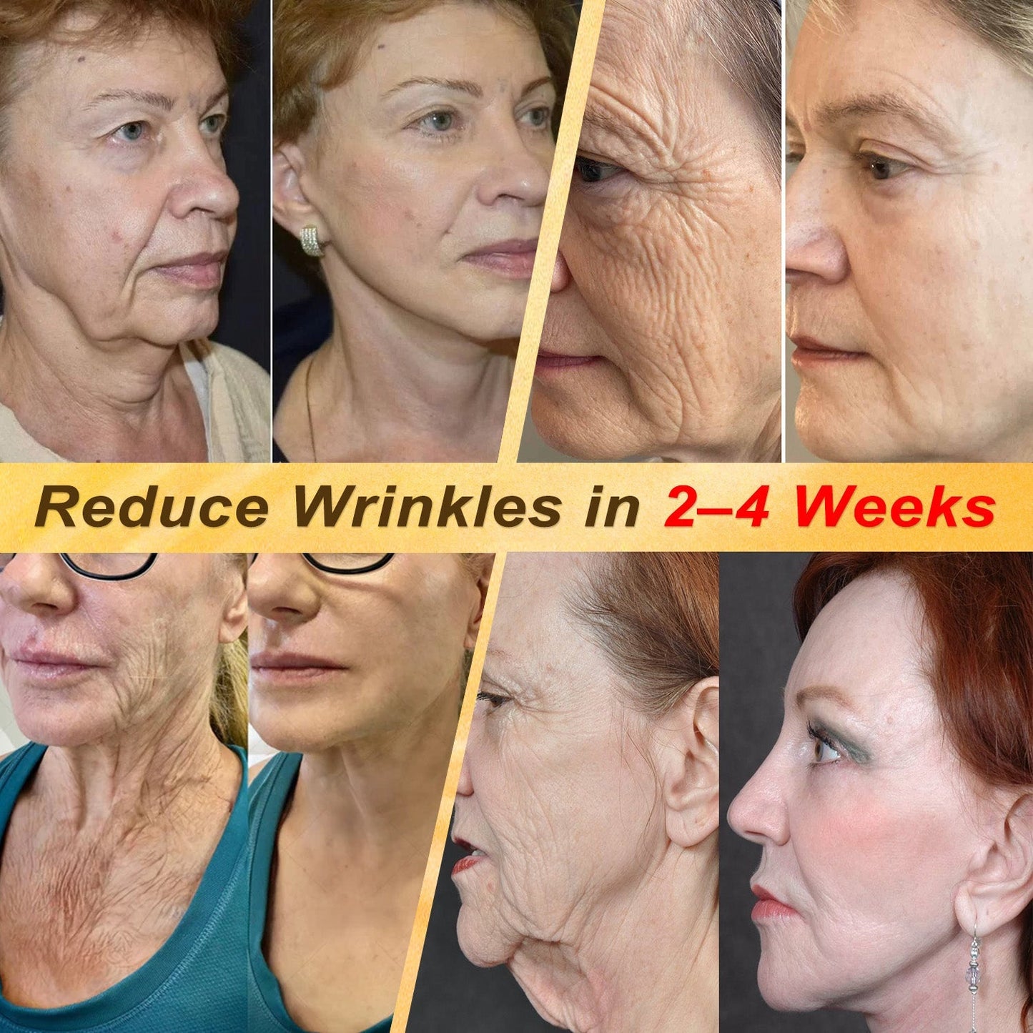 HISKIN® Multi-Concern Skin Repair Cream ✨✨ (One powerful cream to repair inflammation, dryness, aging, pigmentation, and visible skin damage.)