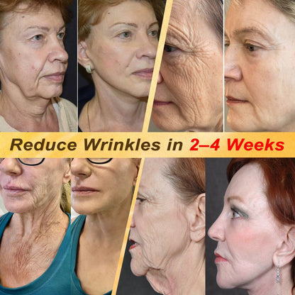 HISKIN® Multi-Concern Skin Repair Cream ✨✨ (One powerful cream to repair inflammation, dryness, aging, pigmentation, and visible skin damage.)