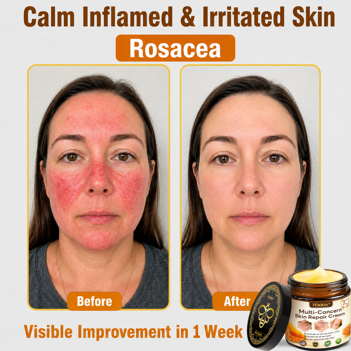 ✨✨HISKIN® Multi-Concern Skin Repair Cream (One powerful cream to repair inflammation, dryness, aging, pigmentation, and visible skin damage.)